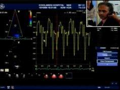 Insat 3A at 93.5 e _ feeds 4 053 V feeds from Kokilaben Hospital India  03